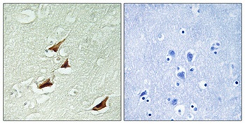 Pdcd-4 (phospho-Ser67) antibody