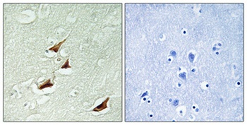 Pdcd-4 (phospho Ser67) rabbit pAb