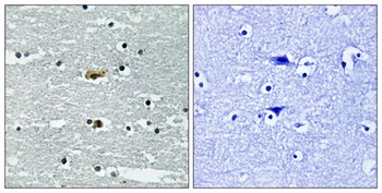 SPAK (phospho Ser309) rabbit pAb