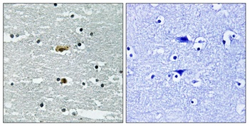 SPAK (phospho-Ser311) antibody