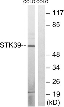 SPAK antibody