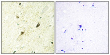 GLI-3 rabbit pAb Antibody