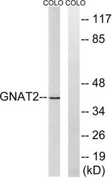 G alpha t2 antibody