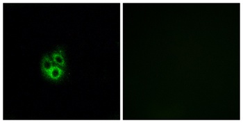 G gamma 5 antibody