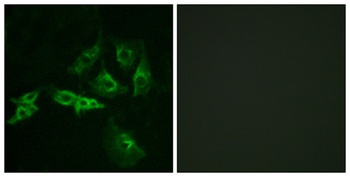 GnRH-R rabbit pAb