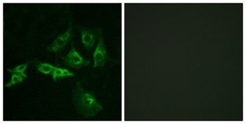 GnRH-R antibody