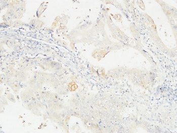 14-3-3 Sigma antibody