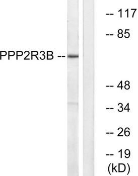 PR48 rabbit pAb