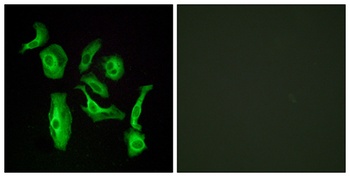 GPR133 antibody