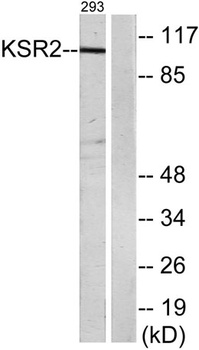 Ksr2 rabbit pAb Antibody
