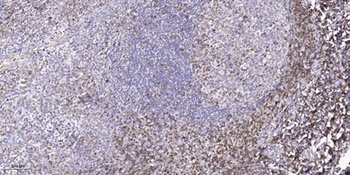 Ksr2 rabbit pAb Antibody