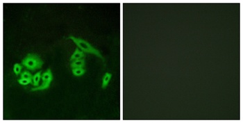GPR12 rabbit pAb Antibody