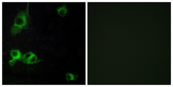 Laminin alpha-1 antibody