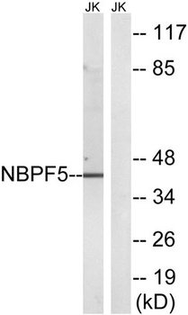 NBPF5 rabbit pAb