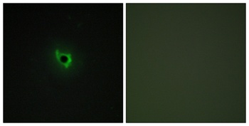 EphA6 antibody