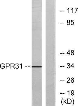 GPR31 rabbit pAb