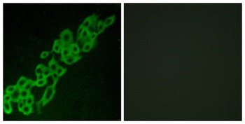 GPR32 rabbit pAb Antibody
