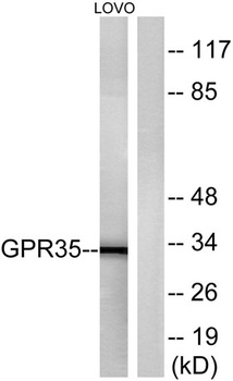 GPR35 rabbit pAb Antibody