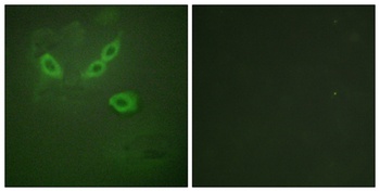 LOST1 antibody