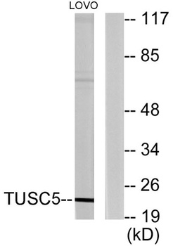 LOST1 rabbit pAb Antibody