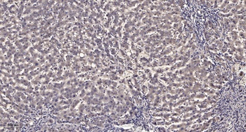 GRK 4 antibody