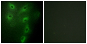 TRIM59 rabbit pAb Antibody