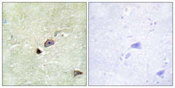 TRIM59 rabbit pAb Antibody