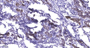 Mnk2 rabbit pAb Antibody