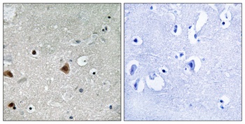 CSN1 (phospho Ser454) rabbit pAb