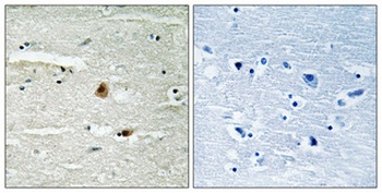 CSN1 antibody