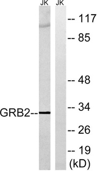 GRB2 rabbit pAb Antibody