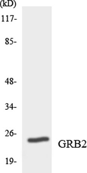 GRB2 rabbit pAb Antibody