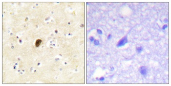 GluR4 (phospho-Ser862) antibody