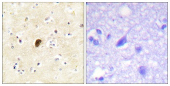 GluR4 (phospho Ser862) rabbit pAb