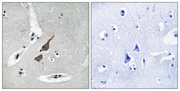 GluR-δ1 rabbit pAb