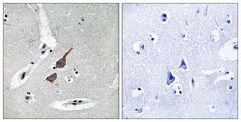 GluR-delta 1 antibody