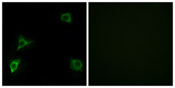 GluR-δ2 rabbit pAb Antibody