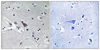 NTT5 antibody