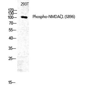 NMDAzeta 1 (phospho-Ser896) antibody