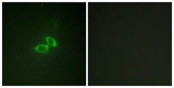 NMDAζ1 rabbit pAb