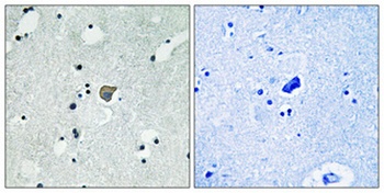 NMDA Epsilon 1/2 (phospho-Tyr1246/1252) antibody