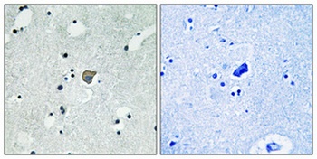 NMDAε1/2 (phospho Tyr1246/1252) rabbit pAb