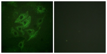 NMDA Epsilon 1/2 antibody