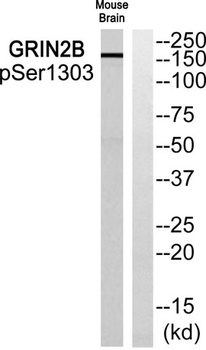 NMDAε2 (phospho Ser1303) rabbit pAb Antibody