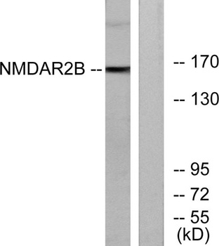 NMDA Epsilon 2 antibody