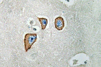 NMDAε3 rabbit pAb