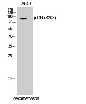 GR (phospho-Ser203) antibody