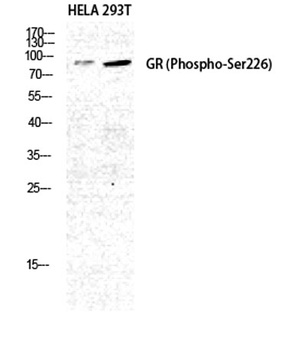 GR (phospho Ser226) rabbit pAb