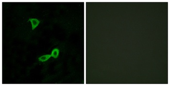 mGluR2 antibody