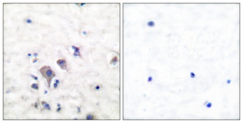 mGluR-2/3 antibody